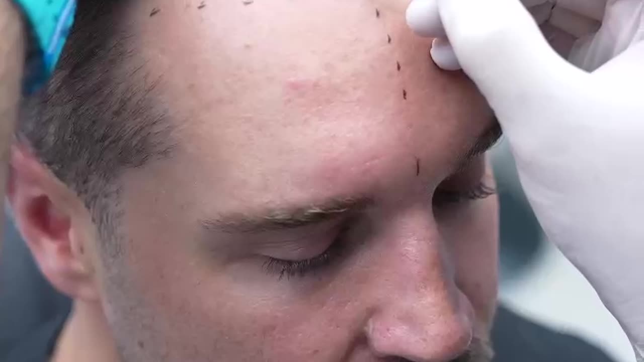 "The process was painless..."