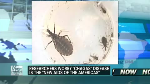 Chagas Disease The New AIDS