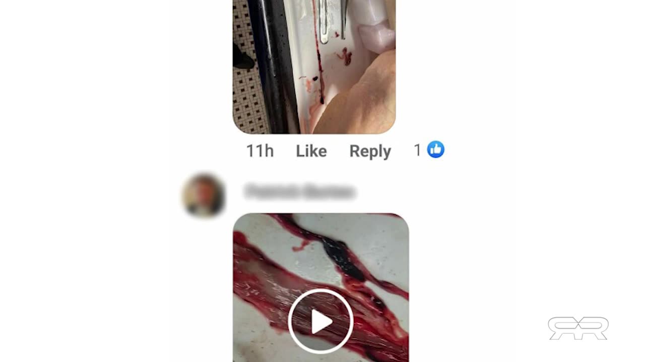 Reese Report-Massive Bio-Structures Found in Bodies of the Vaccinated