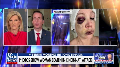 GOP Senator Reveals New Details Cincinnati Woman Shared About Ohio Brawl