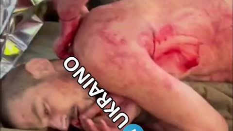 Ukrop Casualty Whining About His Situation