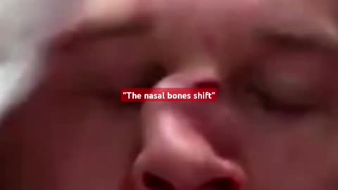 CAPTAIN OBVIOUS - VOL. 93: WHEN YOU BREAK YOUR NOSE