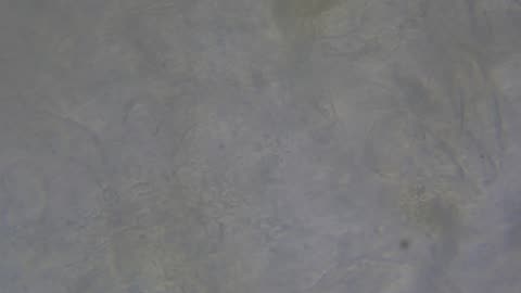 Ear Swab Cytology w/ Live Bacteria