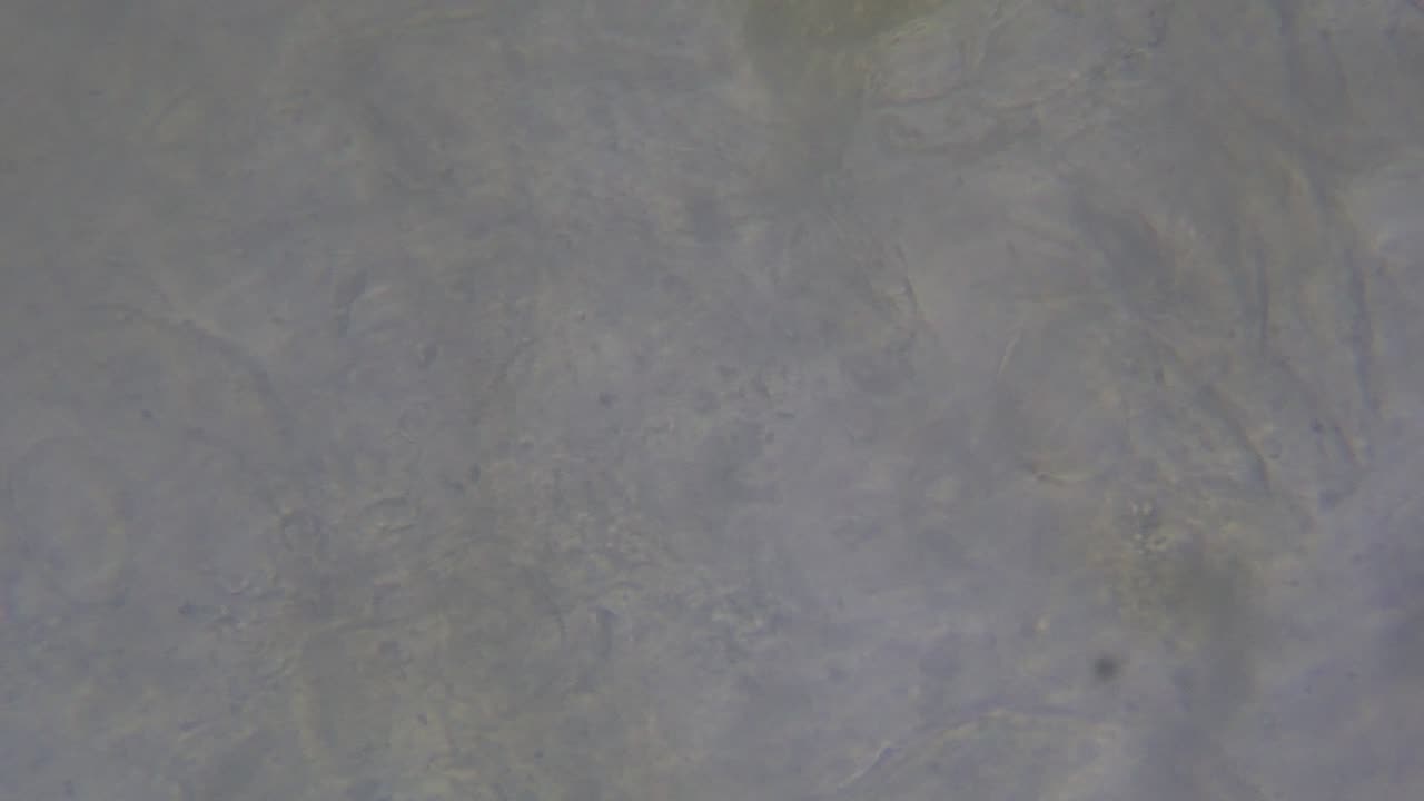 Ear Swab Cytology w/ Live Bacteria