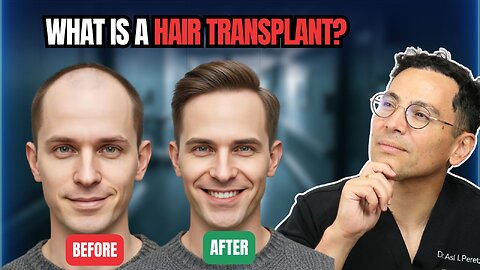 What Is a Hair Transplant? | Explained Simply for Beginners