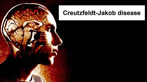 "Creutzfeldt-Jakob (Prion Disease): An Emerging Threat Poised to Claim Millions in 2022"