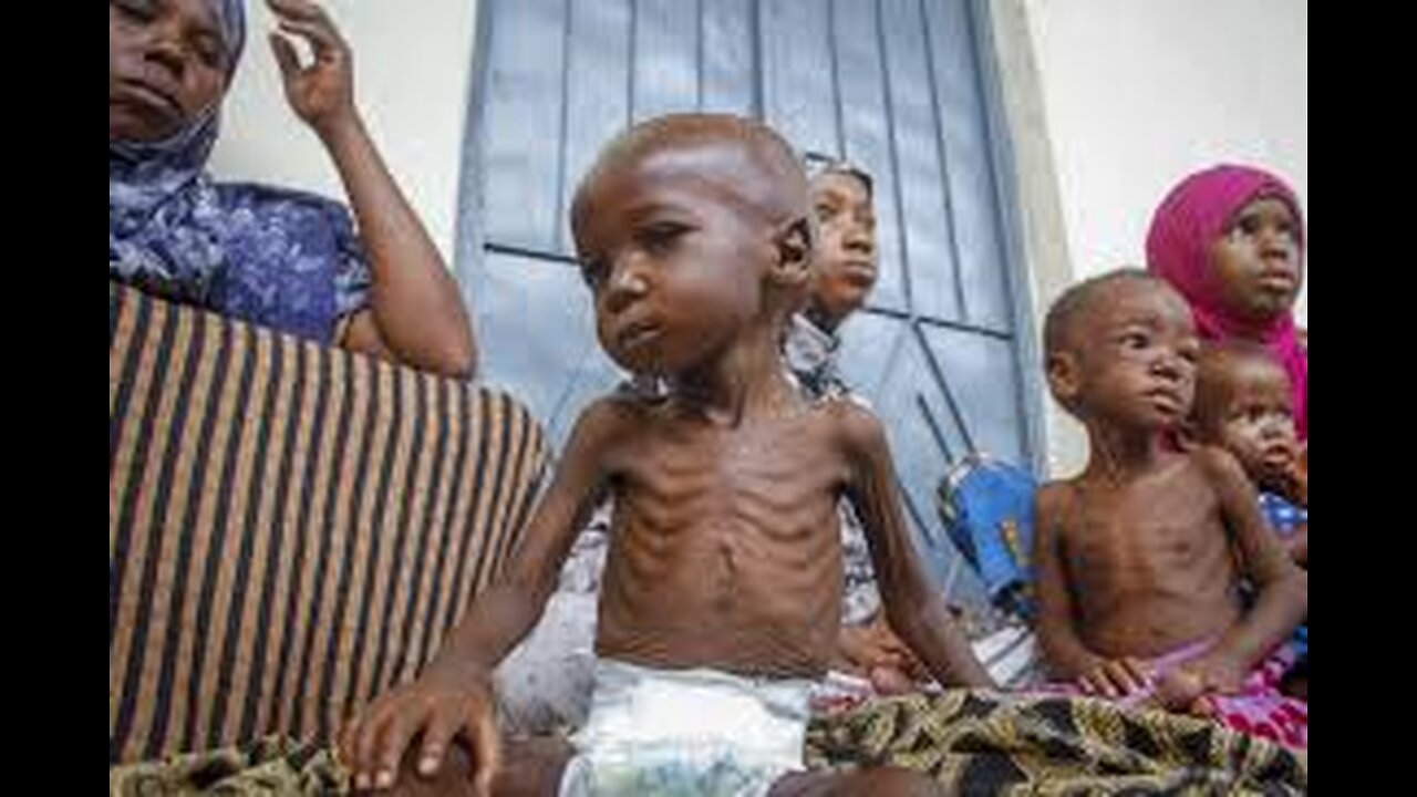 Grandes tueuses : La malnutrition | Inserm [Flokossama]