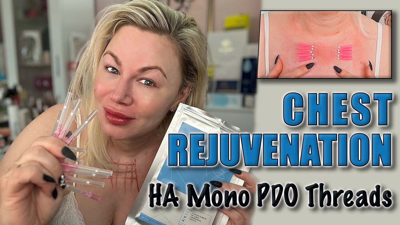 Chest Rejuvination with HA Mono PDO Threads, GlamCosm | Code Jessica10 Saves you money