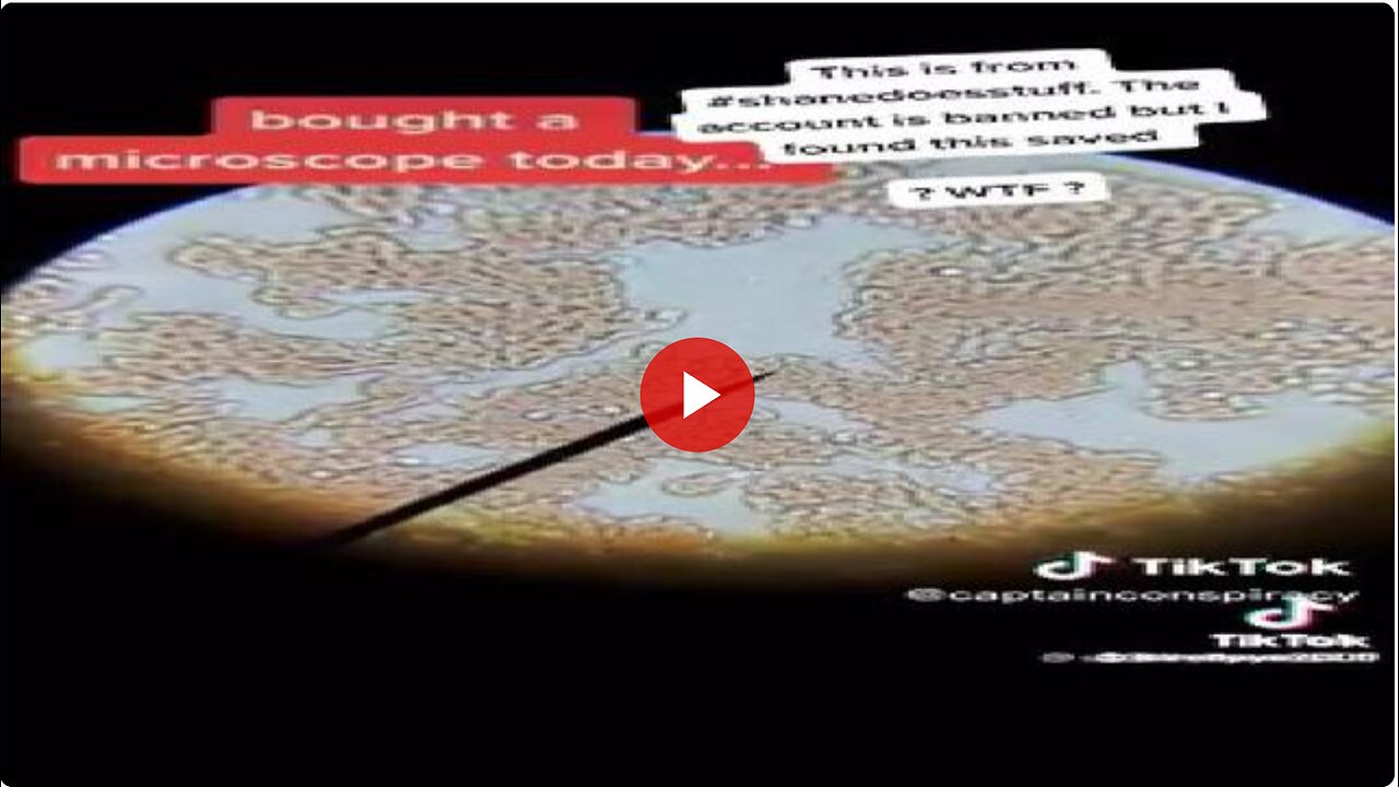 UNVAXXED vs VAXXED (MURDENA) BLOOD