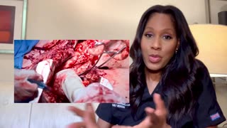 *THE PIT?T* SEASON 2, EPISODE 1: Doctor Reacts. WHAT THE HECK!