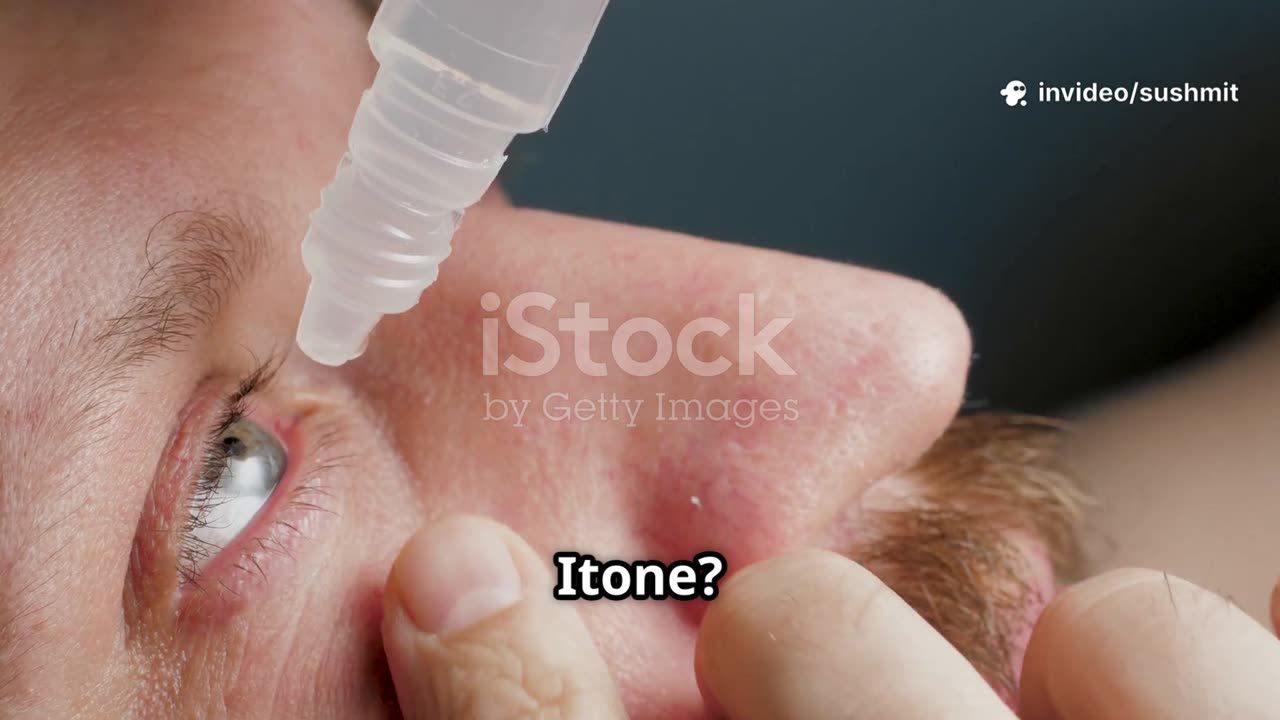 Why Itone Eye Drops Are a Game-Changer for Dry Eyes!