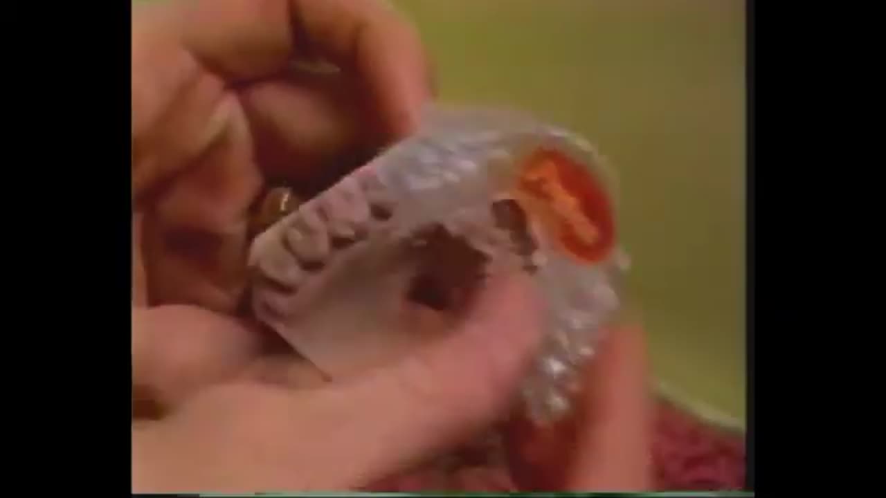 Circa 1983 - Personalized Mouthguards for Athletes