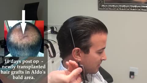 Dr. Brett Bolton: Transformative Hair Restoration & Surgery Experience