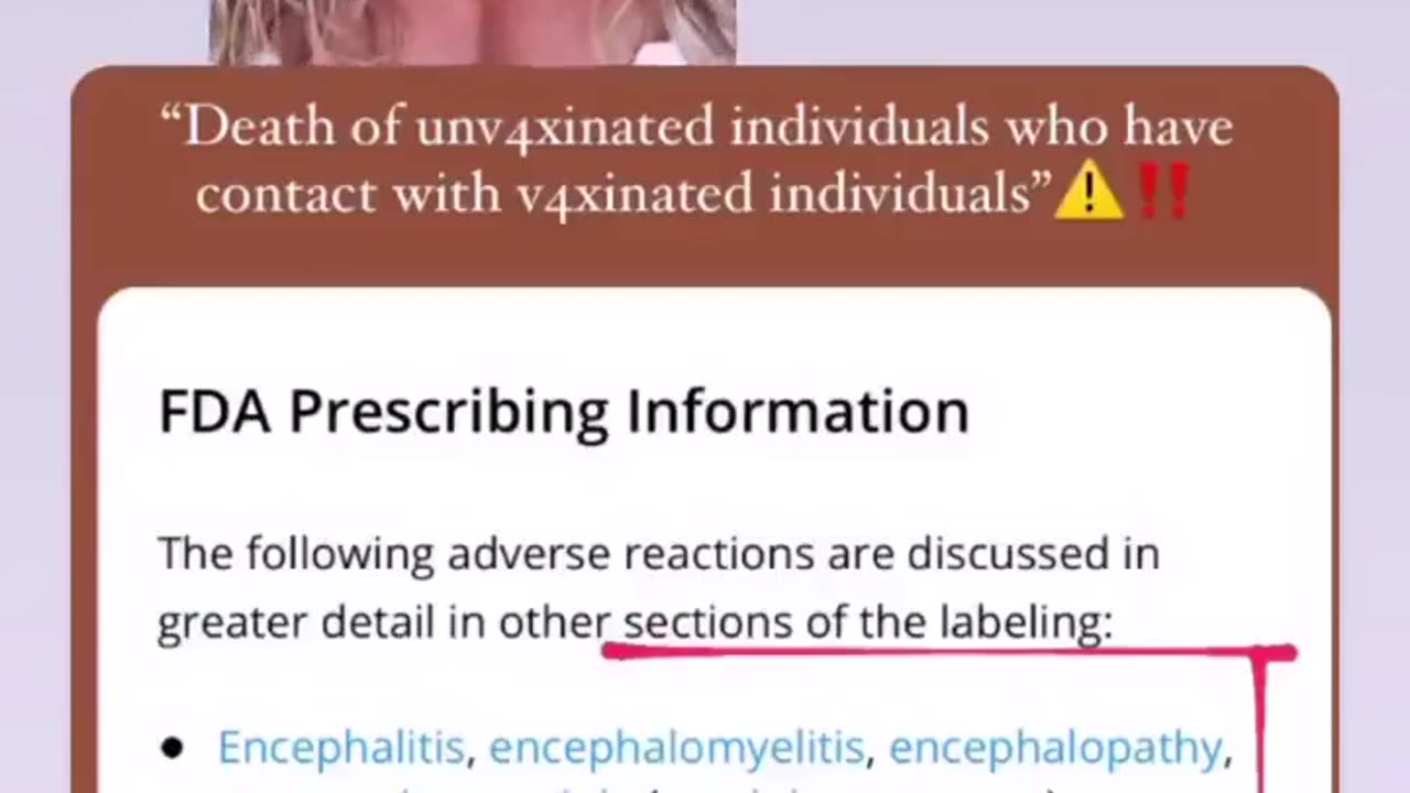 ⛔️BEWARE of the MONKEY POX VAX.. check out the DEATH WARNINGS