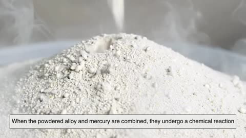Amalgam_ The Secret Formula Behind Dental Fillings _ More!