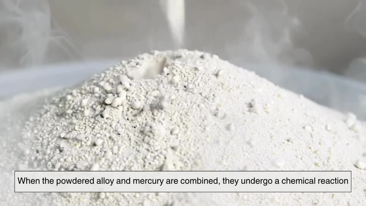 Amalgam_ The Secret Formula Behind Dental Fillings _ More!