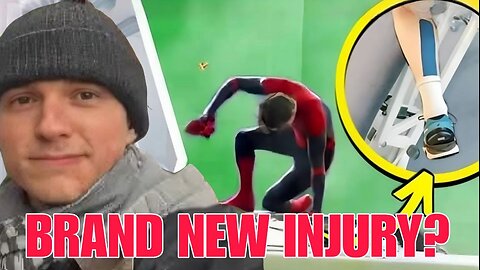 Tom Holland Hospitalized After Spider-Man 4 Stunt Accident | Fans Fear Delays