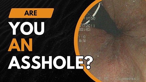 Are You A Non-Famous Hole Of An Anus?