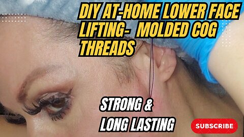 DIY AT-HOME JAWLINE LIFTING WITH MOLDED COG THREADS + BEFORE & AFTER