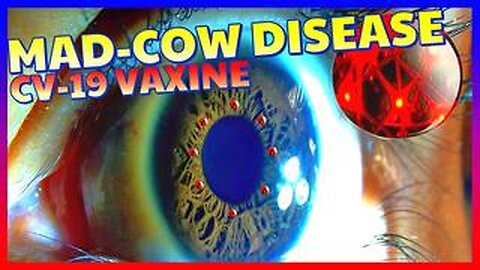 Mad cow (prion) disease will affect millions of people who have taken the CV-19 toxic injection