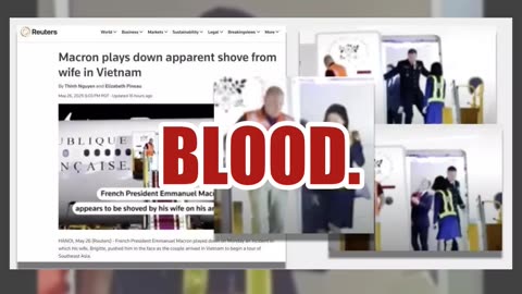 Fact Check: Screengrab Does NOT Show Macron Plane Attendant With A 'Ripped Bloody Shoulder'