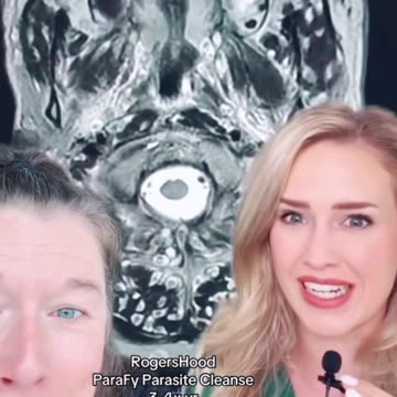 Got parasites? 🤯🤦‍♂️ You might have. - #neurocysticercosis