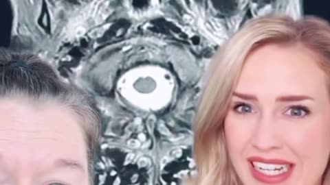 Got parasites? 🤯🤦‍♂️ You might have. - #neurocysticercosis