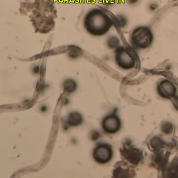Baking Soda VS Human Parasites (+Eggs) 🤔