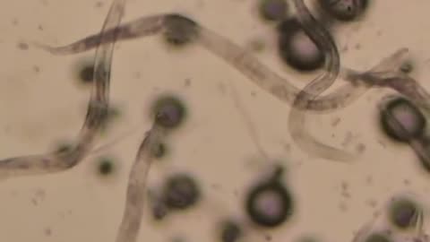 Baking Soda VS Human Parasites (+Eggs) 🤔