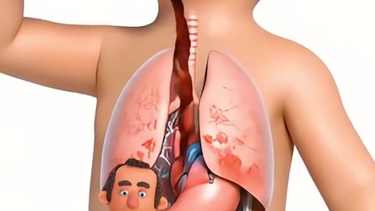 Dr Pickles ~ What Happens If You Drink Coca-Cola Every Day? #health #cocacola