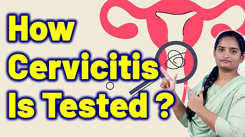 Essential Tests For Cervicitis, Acute Cervicitis, Cervical Swelling. Treatment Medicine Gynaecology
