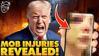 First Victim Photos of Black Mob Attack in Ohio SHOCK internet, Horrific Injuries| Hate Crime Charge