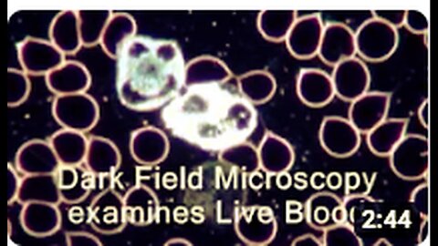 "Exploring Live Blood Analysis and Dark Field Microscopy - Part 2"