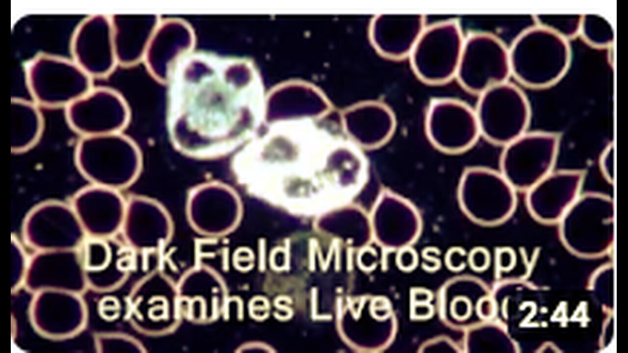 "Exploring Live Blood Analysis and Dark Field Microscopy - Part 2"