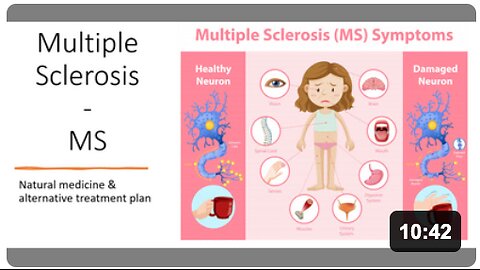 Multiple Sclerosis - MS Natural Treatment
