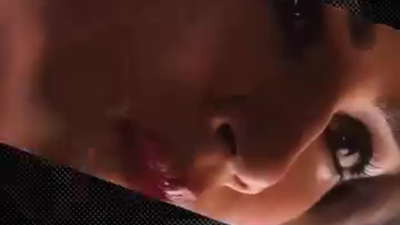 viral seen