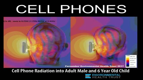 Wireless Cell Phone Radiation Penetrates The Brain: Scientific Imaging