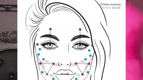 Mesotherapy with Miracle L Facelift in a bottle Estaderma.com Code JAMIE15