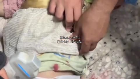A little girl (4 years old) was shot by an Israeli drone in Sheik Radwan neighborhood
