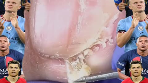 Cleaning is very needed! Home Service Pedicure Series #ingrowntoenail #toenails #pedicure (2)