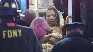 Man Set On Fire In Times Square, Leaving Him Horrifically Burned