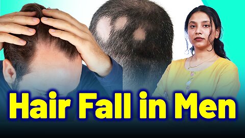 Hair Fall in Men, Male Pattern Baldness.| Treatment Cure Relief Medicine | Skin Hair Nail