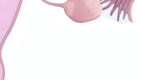 floppin tube recannulation