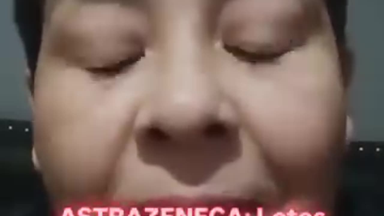 VICTIMA DE LA VACUNA AZTRASENICA ..TERMINA CON TROMBOSIS , DERRAME ,