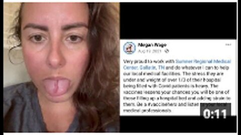"Vaxxtard Claims 'Covid Tongue' as Adverse Vaccination Event"