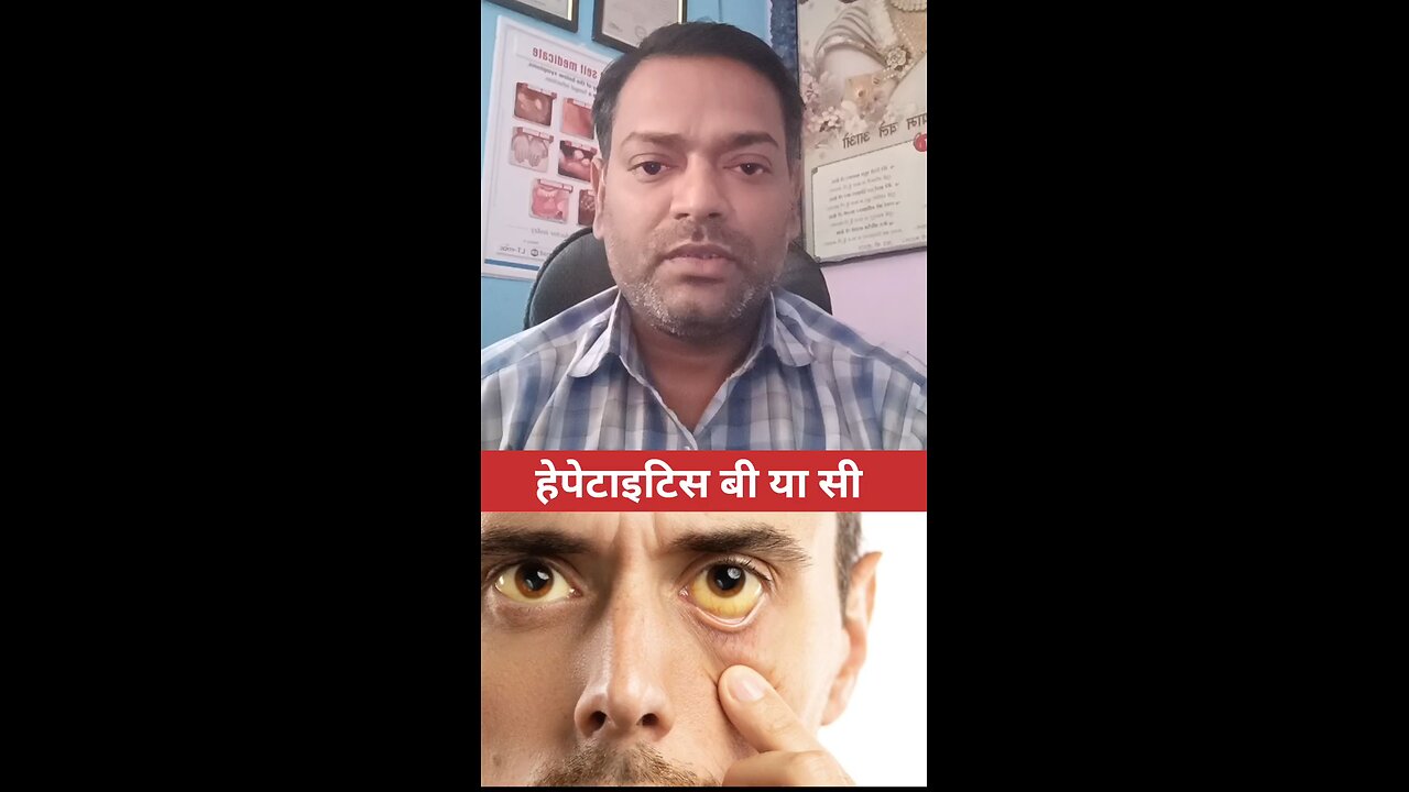 हेपेटाइटिस बी या सी ।