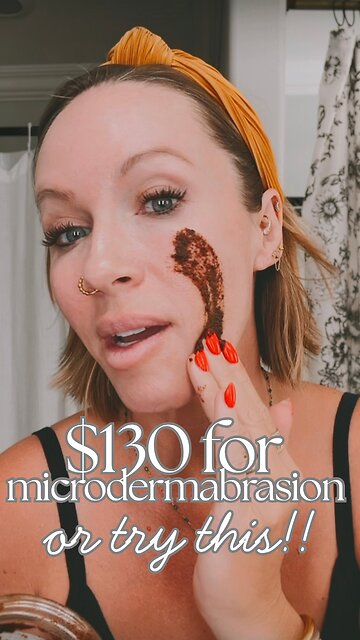 $130 for Microdermabrasion or Try This