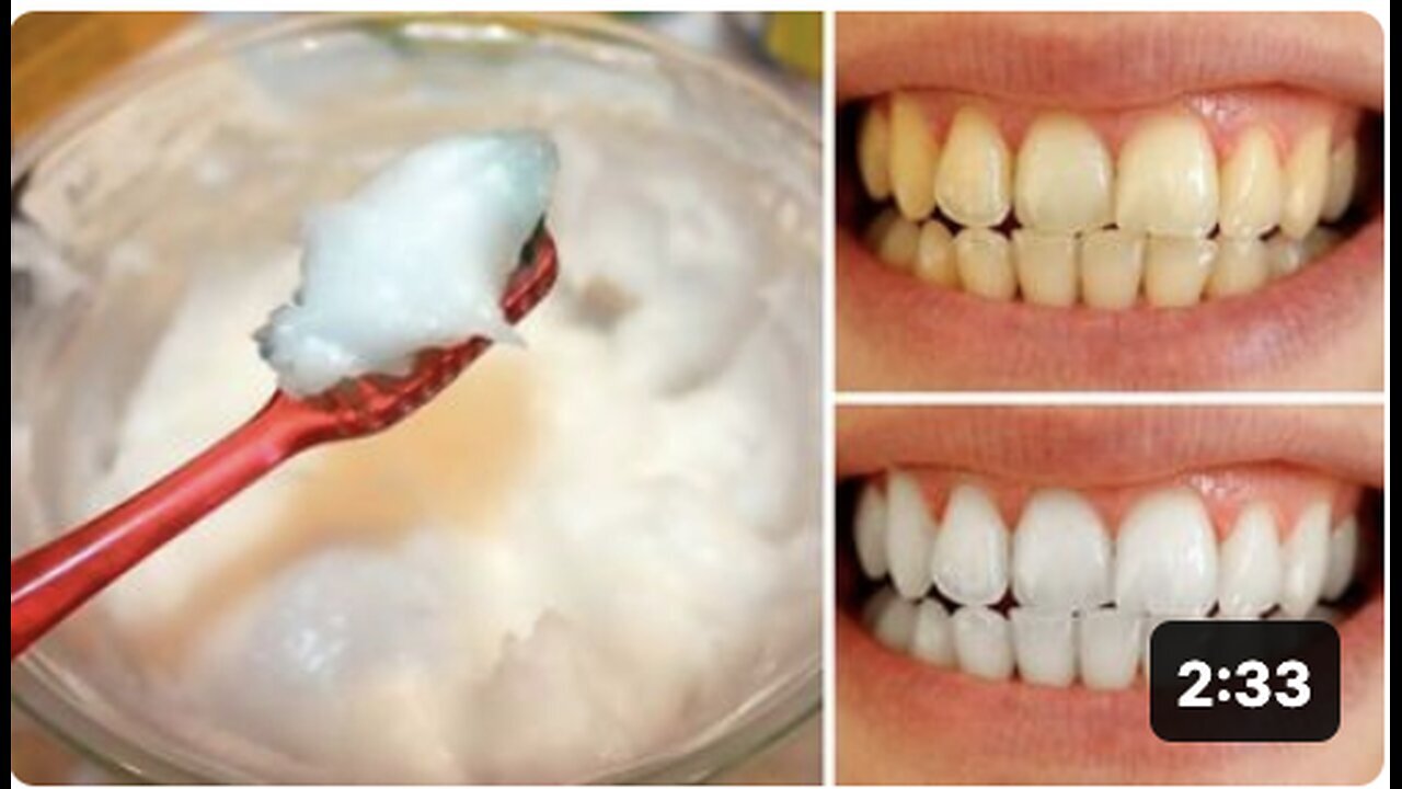 "Naturally Whitening Your Teeth at Home in 3 Minutes: A Guide"