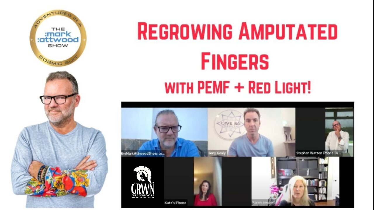 Regrowing Amputated Fingers with PEMF + Red Light! - 5th June 2025