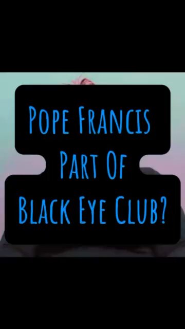 Pope Francis Part Of Black Eye Club? 😳